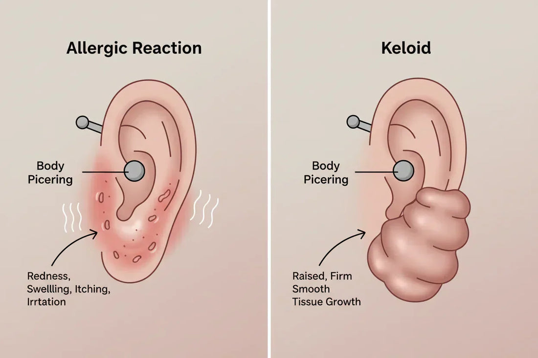 Allergic Reaction vs Keloid: How to Tell the Difference After a Piercing