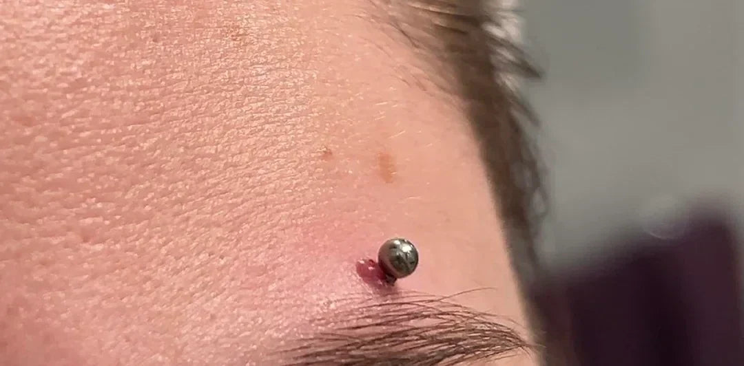 Eyebrow Piercing Irritation Bump: How to Treat & Prevent It
