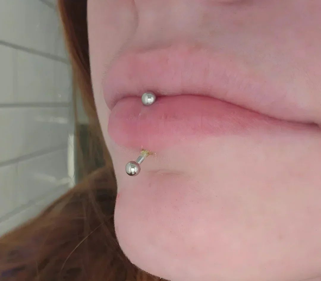How to Spot and Treat an Infected Lip Piercing