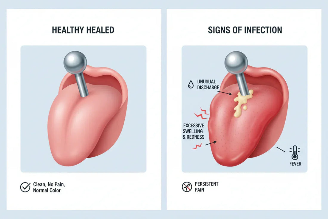 Infected Tongue Piercing:Signs of an Infected Tongue Piercing