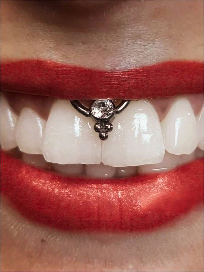How Long Do Smiley Piercings Last? Lifespan, Healing & What to Expect