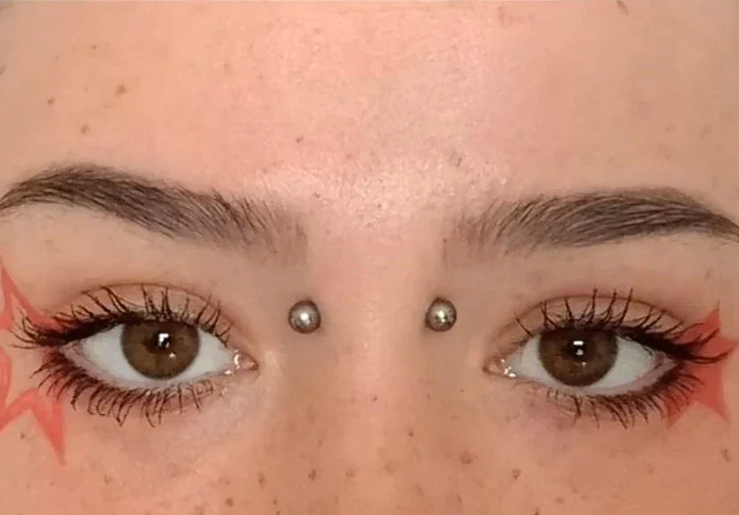 Why Do I Have a Bump on My Bridge Piercing?