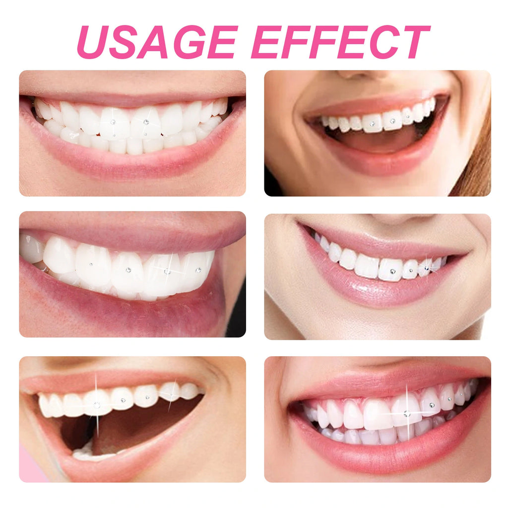 Tooth_Gem_Kit_DIY_Crystals_Jewelry_Kit_Teeth_Gems-usage-effect